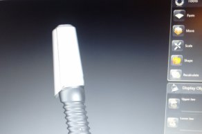 Egyéni implantátumfej cirkonból